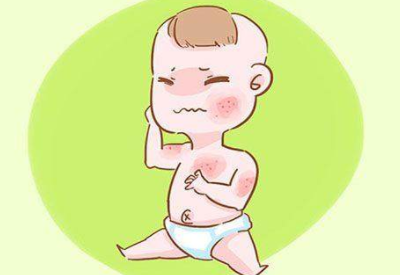 嬰兒喝母乳起濕疹是怎麽回事